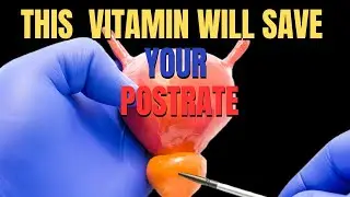 Shrink Your Enlarged Prostate with this one Tiny Vitamin a Day
