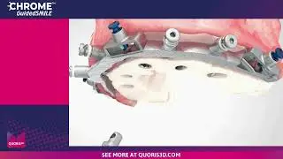 CHROME GuidedSMILE in Action