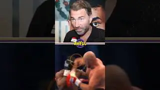 Eddie Hearn Reacts to Tyson Fury vs Francis Ngannou 🔥