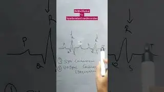defibrillation vs synchronized cardioversion 