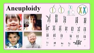 aneuploidy