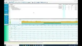 KTResult3 заключение на простой записи