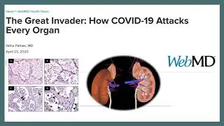 Dr. Kiprov - Apheresis and COVID-19 at Canadian Apheresis Group Virtual Meeting
