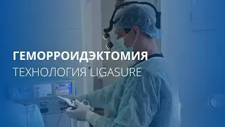 Геморроидэктомия с применением технологии Ligasure