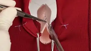 Anal sphincter repair training