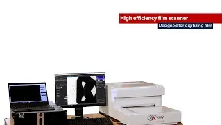 X-Ray film scanner