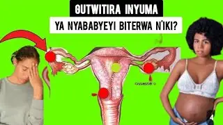 DORE IMPAMVU N'INGARUKA ZO GUTWITIRA INYUMA YA NYABABYEYI (MU MA TROMPES)