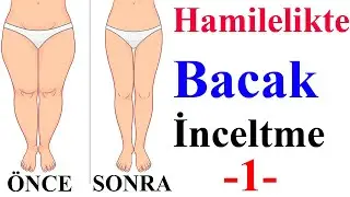 Hamilelikte Bacak İnceltme -1