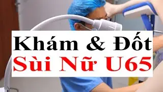 Performing Examination and Burning of Genital Warts with Electric Knife for Patient U65 | Doctor Sac
