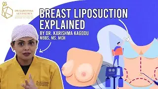 Breast Liposuction || Dr. Karishma Kagodu || Dr. Karishma Aesthetics Bengaluru India