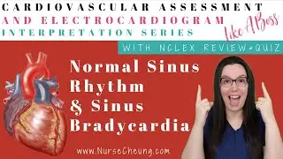 Normal Sinus Rhythm & Sinus Bradycardia | Cardiovascular Assessment & ECG Interpretation Like A Boss