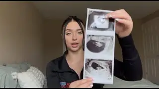 Diary of a single mom to be/1st Trimester