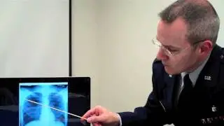 How to sound during your radiology oral exam next week.... and how NOT to sound
