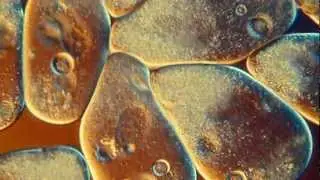 Paramecium aurelia, 400X. DIC