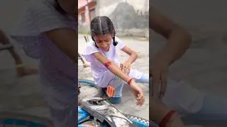 करिश्मा साइकिल से टकराई और चोट लग गई 😱🩸#short #emotional