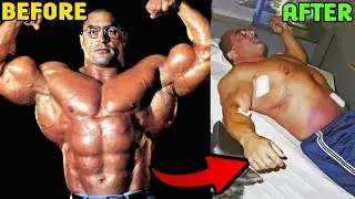 10 Bodybuilders That Died From Steroids Addiction