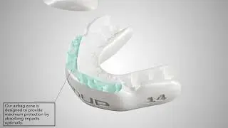 3D Dentistry Animation