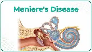 Meniere's Disease 🌀 : ENT Lectures