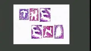 Is Gleason 3+3=6 Really Cancer? Yes Dr  J Epstein