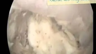 Videootoscopie d'un chien