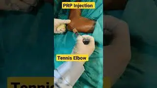 PRP Injection Elbow Live ✓✓ | 