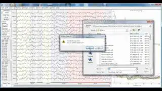 NeuroGuide EEG Editing