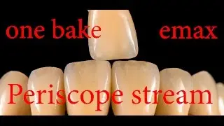 Секреты Стоматологии прямые трансляции в Periscope
