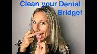 How to Clean Your Dental Bridge!!