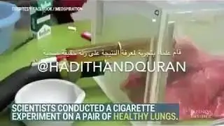 Ini hasil paru paru sesudah menghisap rokok 20 batang , bikin ngeri