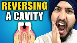 How to Reverse a Dental Cavity at Home