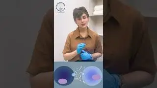 Exosome Therapy for Hair fall!