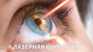 Лазерная коррекция. PROЗРЕНИЕ