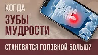 Когда ЗУБЫ МУДРОСТИ становятся ГОЛОВНОЙ БОЛЬЮ: ПРОФИЛАКТИКА И ЛЕЧЕНИЕ.