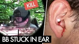 BB Stuck In Ear - Airsoft Injury | Sniper Gameplay