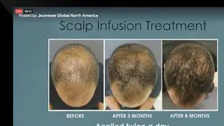Jeunesse Global RVL Scalp Infusion