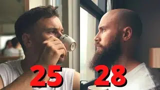 GOING BALD IN YOUR 20's - EVERYTHING YOU WANT *And Need* TO KNOW