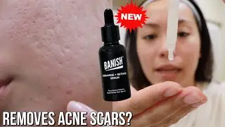 NEW Banish Ceramide + Retinol Serum