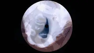Jacque Saravanté, Lina Prey - Lolita