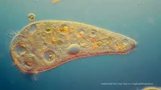 Various protists including Stentor from a coastal stream. DIC, 325X.
