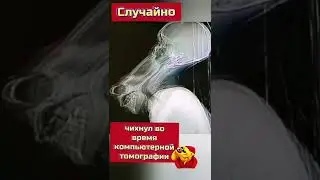 Чих КТ