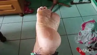 TAG 224/ Óleo no Pé