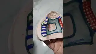 How To Make A Wax Pattern For A Cast Partial Denture