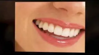 Camarillo Orthodontist Results