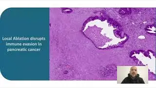 Stereo-seq Webinar | Revolutionizing Research with Spatial Transcriptomics