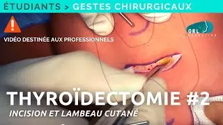 Comment réaliser une thyroïdectomie |  #2 Incision et lambeau cutané | Formation chirurgie ORL