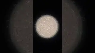 Inside the Lab: Sperm Under the Microscope! 