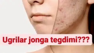 UGRILAR HAQIDA VA QUTILISH YOʻLLARI
