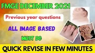 FMGE DECEMBER 2021 PREVIOUS YEAR image based questions revisions #fmge #neetpg #mbbs #next #fmge2023
