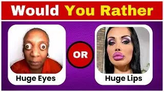 Would You Rather...? 70  HARDEST Choices Ever! 🤔😱🔥| Quiz Thinker