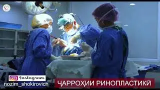 Нозим Шокирович. Ринопластика носа. Душанбе Таджикистан.